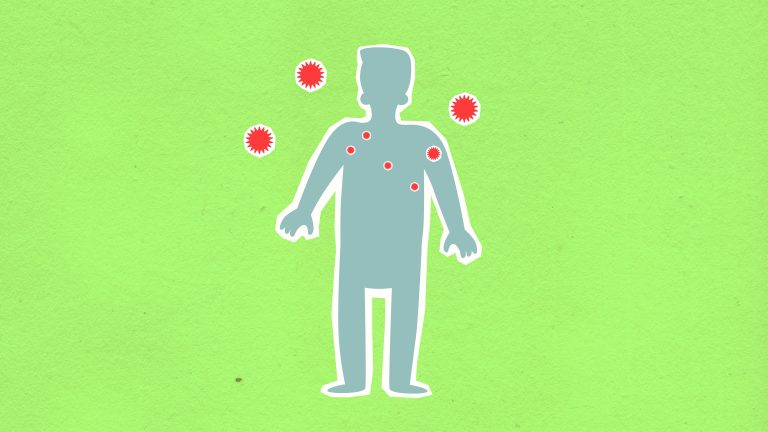 Hantavirus-outbreak-2026